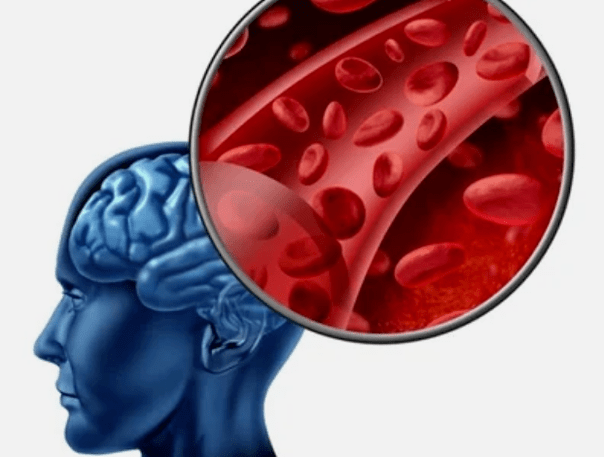 The neck osteochondrosis