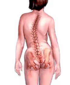 The pathology of the muscle bone system