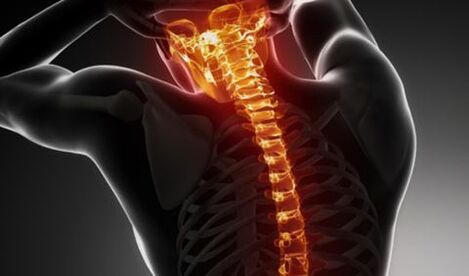 The total spine osteochondrosis