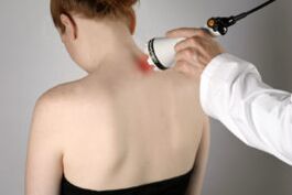 Treatment of cervical osteochondrosis with laser therapy