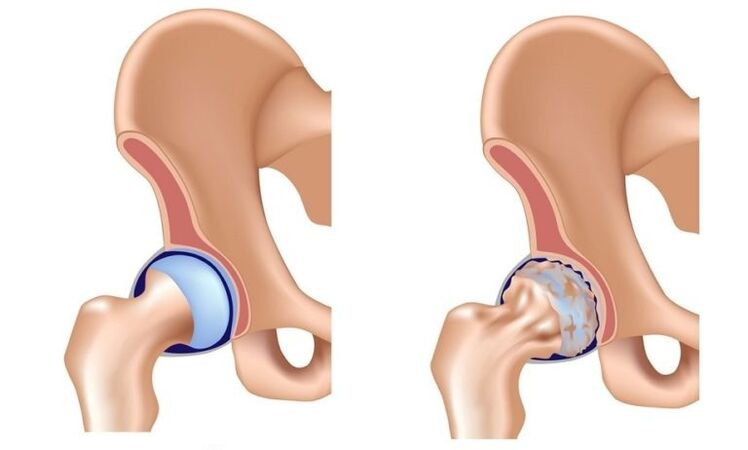 Healthy joint and joint is a joint joint