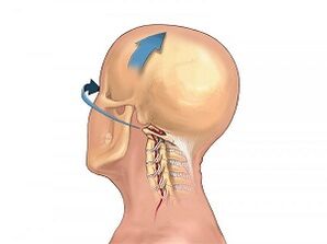 How does the cervical spine manifest itself osteochondrosis