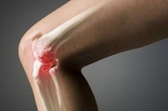 The knee joint arthrosis is the lesion of cartilage tissue